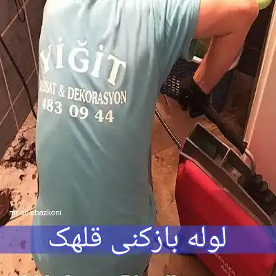 لوله بازکنی قلهک