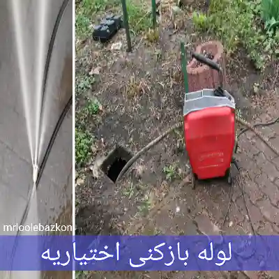 لوله بازکنی اختیاریه